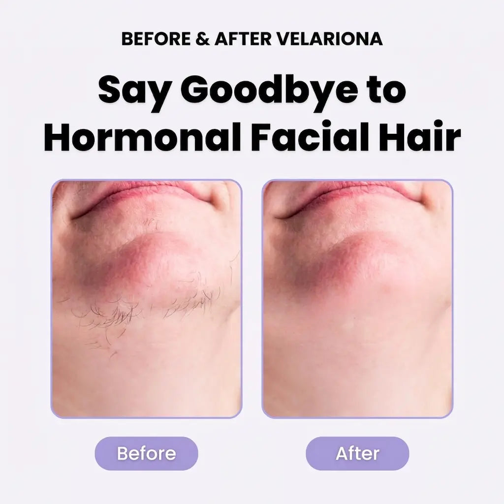 Velariona™ Pro Epil