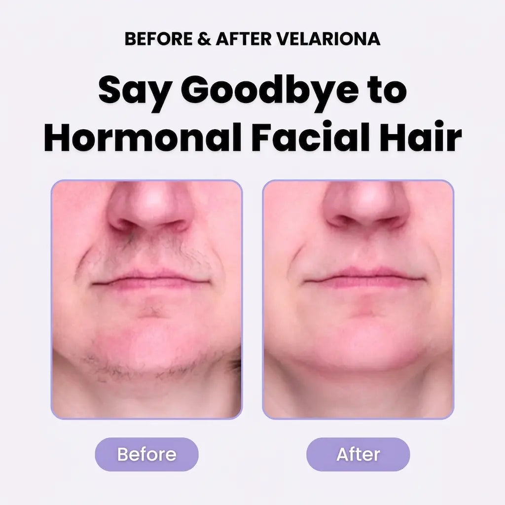 Velariona™ Pro Epil