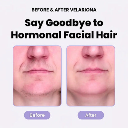 Velariona™ Pro Epil